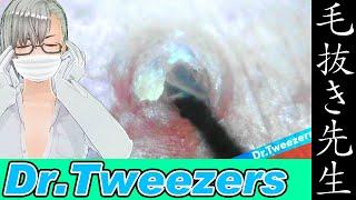 364 [200x Zoom]  Dr. tweezers 毛抜き先生の角栓や毛根