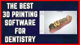  The 3 Best FREE 3D Printing Software for Dentists