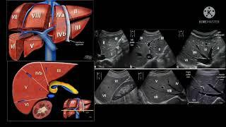 Learn Anatomy of liver on ultrasound at a glance.
