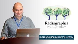 Гамлет Мкртчян. Пункционная биопсия образований легкого под  контролем КТ