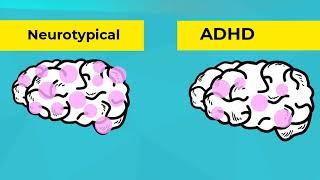 Infographics: What is ADHD?