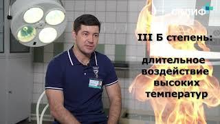 Как лечить ожоги? Как считают площадь ожогов на теле? Кто такой комбустиолог?