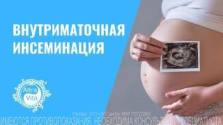 Внутриматочная инсеминация