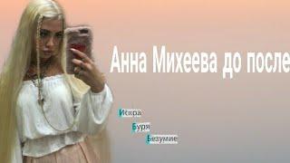 Аня Михеева до/после