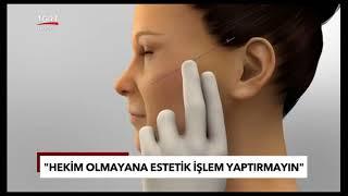 Doktorumuz, Fransız Askısı Deep Lifting Nasıl Yapılır. TGRT Ana Haberde Anlatıyor #facelift #estetik