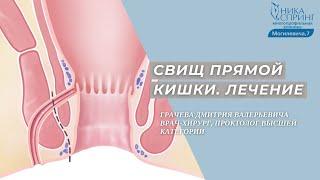 Свищ прямой кишки. Лазерное лечение в Нижнем Новгороде. Проктолог Грачев Дмитрий Валерьевич