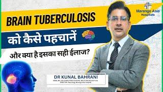 Brain Tuberculosis को कैसे पहचानें और क्या है इसका सही ईलाज? | Brain TB in Hindi | Dr. Kunal Bahrani