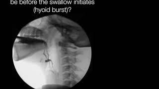 Normal Bolus Depth During Swallowing