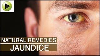 Jaundice - Natural Ayurvedic Home Remedies