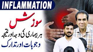 Inflammation Is The Root Of Every Disease | What Are the Reasons Behind It | DR Shahzad Basra