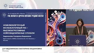 Немелкоклеточный мелкоклеточный рак – высокоагрессивные нейроэндокринные опухоли