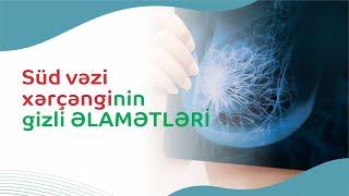 Süd vəzi xərçənginin gizli ƏLAMƏTLƏRİ..#südvəzixərçəngi