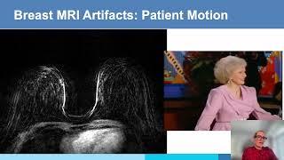 ISMRM MR Academy: Artifacts in Breast MRI