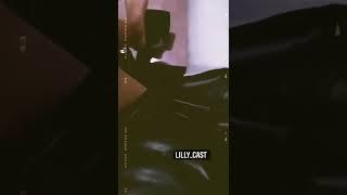 LONG LEG CAST WOMAN #legcast #wheelchair