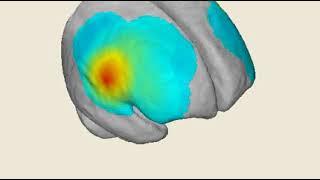 Using Light to Monitor Brain Activity - Dr. Nasser Kashou