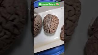 Human Brain #Mbbs#Shkmgmc #Human#Brain#Anatomy#Dissectionhall️