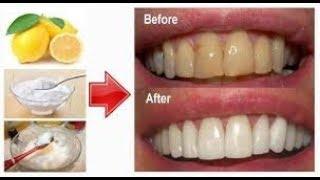 How to whiten teeth using baking soda