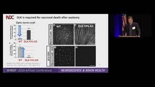 TAMEST 2019: Jim Ray on Neurodegeneration and Alzheimer's