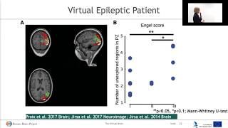 The Virtual Brain Platform: Applications in medicine and research