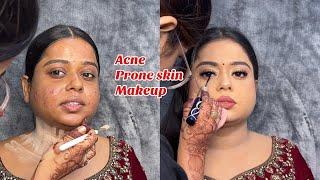 ACNE PRONE SKIN MAKEUP TUTORIAL  REAL BRIDAL MAKEUP