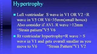 ECG Course 1