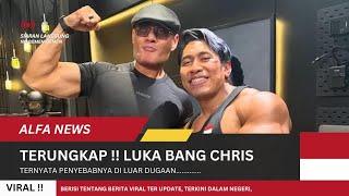 VIRAL !! PODCAST DEDY CORBUZIER DENGAN BANG CHRIS SANG BINARAGA MENCURI PERHATIAN KARNA BEKAS LUKA