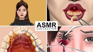 Combine ASMR Treatment 2D Animation | ASMR Care Treatment Animation Compilation | JINJJA 진짜 ASMR