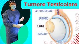 Il tumore testicolare: cosa fare ?