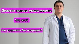 Диастаз прямых мышц живота  Что это? Как устранить без операции? Абдоминопластика Пластика живота