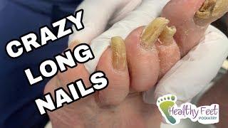 Crazy Long Thick Nails