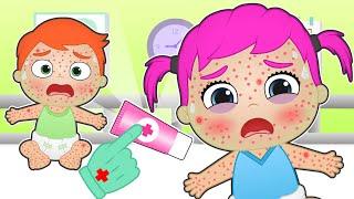 BABIES ALEX AND LILY have MEASLES  How to cure a baby