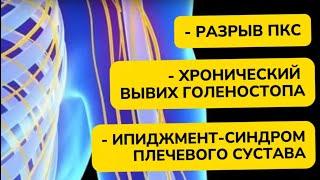 Как помогут коррекционные упражнения, если у вас есть проблема в суставе? Мини-лекция!