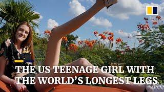 The US teenage girl with the world’s longest legs