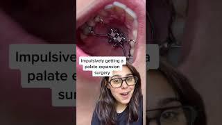 Orthodontist Reacts: Giant Tooth Gap From Expander And Jaw Surgery  #shorts