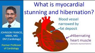 What is myocardial stunning and hibernation?