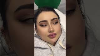 Kosmetolog dr_ergashevna 90 1221213 faqat ayollarga xizmat ko’rsatiladi
