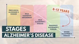 Stages and Life Expectancy of Alzheimer's Disease