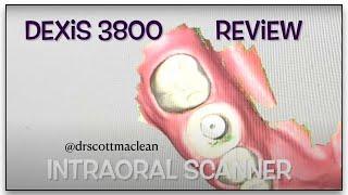 Intra Oral Dexis 3800 Review - Dental