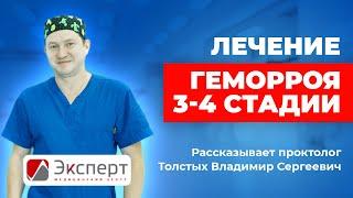 Лечение геморроя. 3-4 стадия