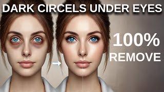 DARK CIRCELS UNDEY EYES 2025 | Dark Circles Under Eyes Home Remedy 2025