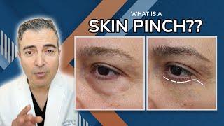 Healing After Skin Pinch | Dr. Kami Parsa