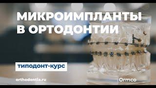 Микроимпланты в ортодонтии. Практические советы. Типодонт-курс Ильяра Нуртдинова