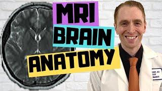 MRI Brain Anatomy Explained by Neurologist