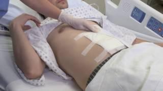 Rehabmart.com | Abdominal Binder Compression Belt