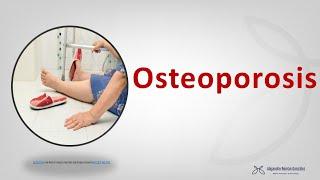 Osteoporosis post-menopáusica. Diagnóstico y tratamiento