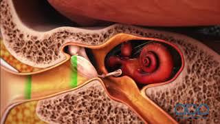 How the Ear Works -  3D Medical Animation || ABP ©