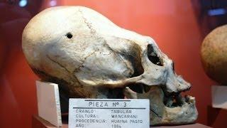 Secret Filming Of Odd Elongated Human Skulls In Bolivia