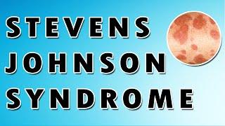 Stevens Johnson Syndrome Symptoms, Treatment, and Causes