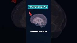 Scientists Discover "Unbelievable” Levels of Microplastic in Human Brains