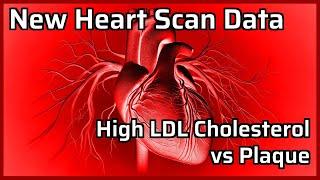 BREAKING – New Heart Scan Data on High LDL Keto